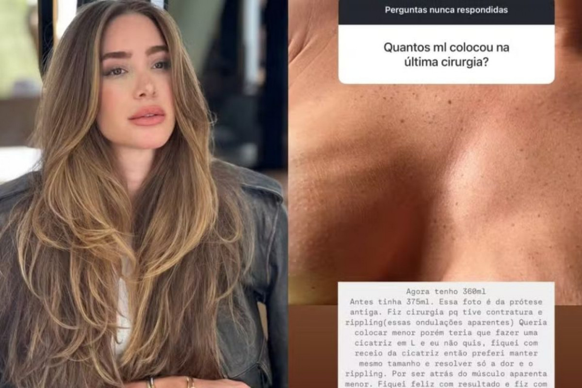 Romana Novais falou sobre o assunto em suas redes sociais (Reprodução/Instagram) Romana Novais falou sobre o assunto em suas redes sociais /Reprodução/Instagram