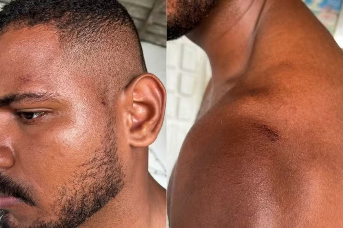 Homem registrou boletim de ocorrência e fez corpo de delito ( Foto: Reprodução) Homem registrou boletim de ocorrência e fez corpo de delito/ Foto: Reprodução