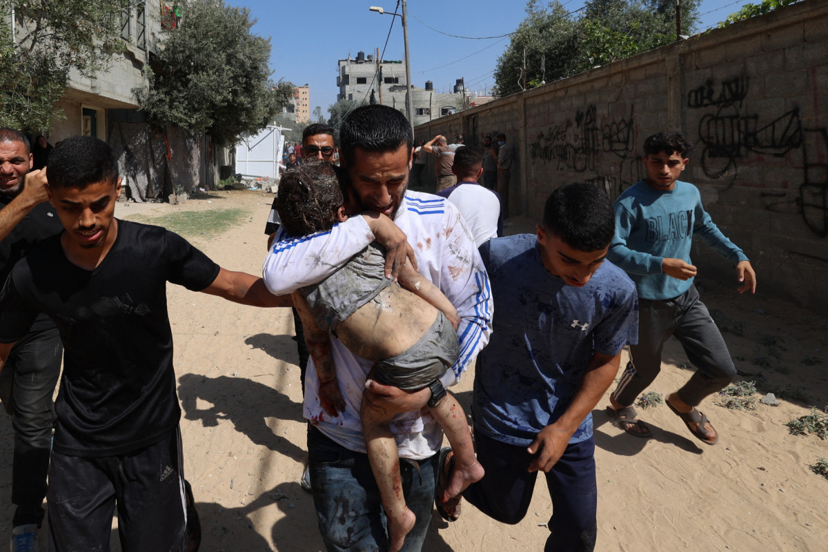 Criança ferida na Faixa de Gaza (EYAD BABA / AFP) Criança ferida na Faixa de Gaza/EYAD BABA / AFP