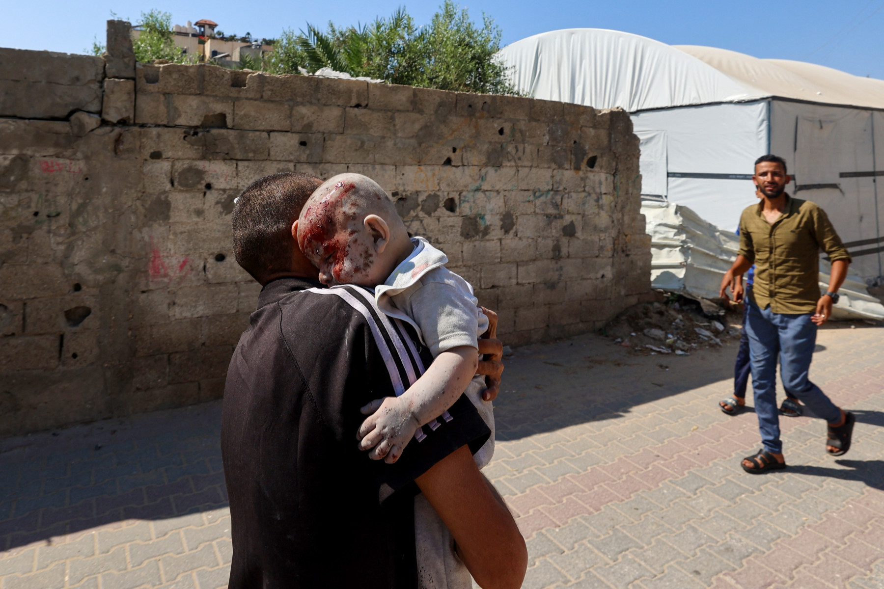 Criança ferida na Faixa de Gaza