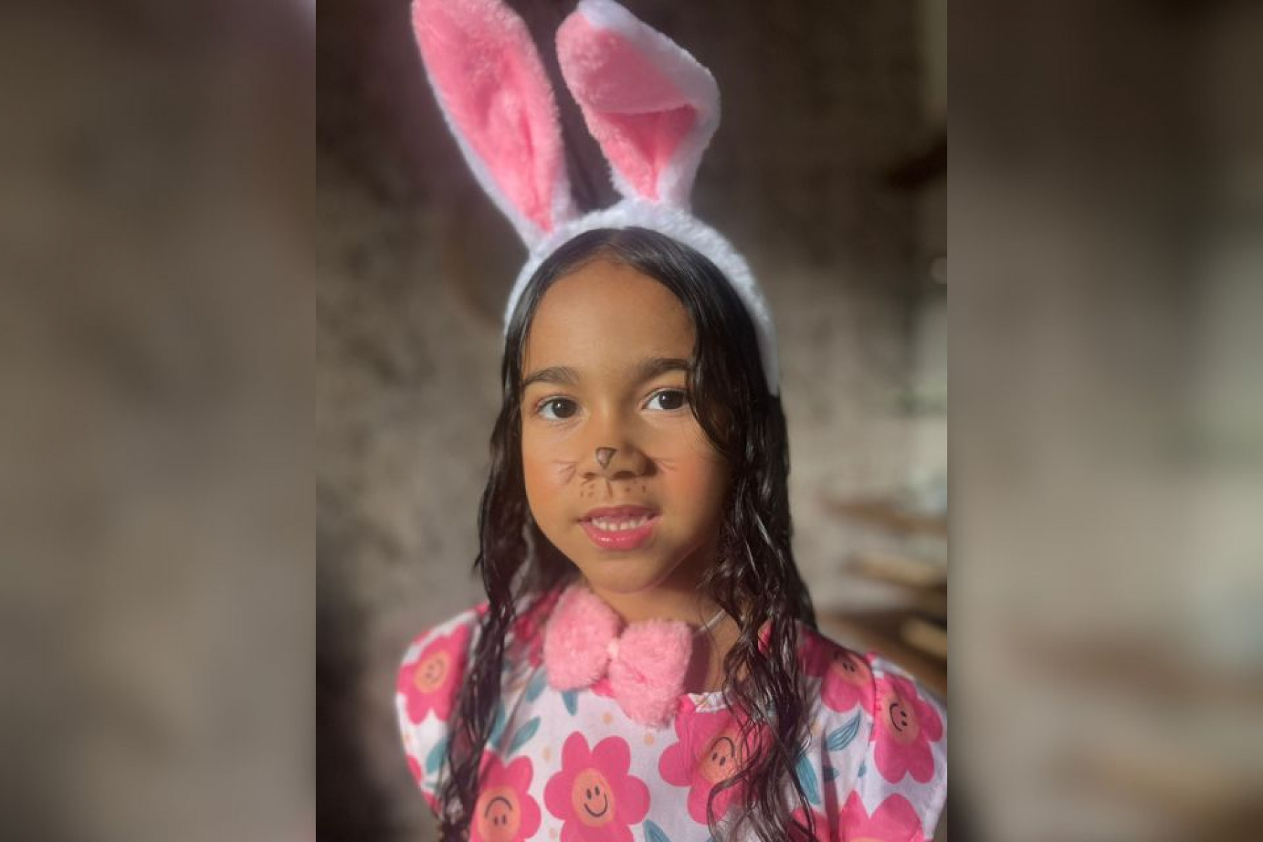 A garota segue internada em estado grava no Hospital da Restauração (HR), na região central do Recife