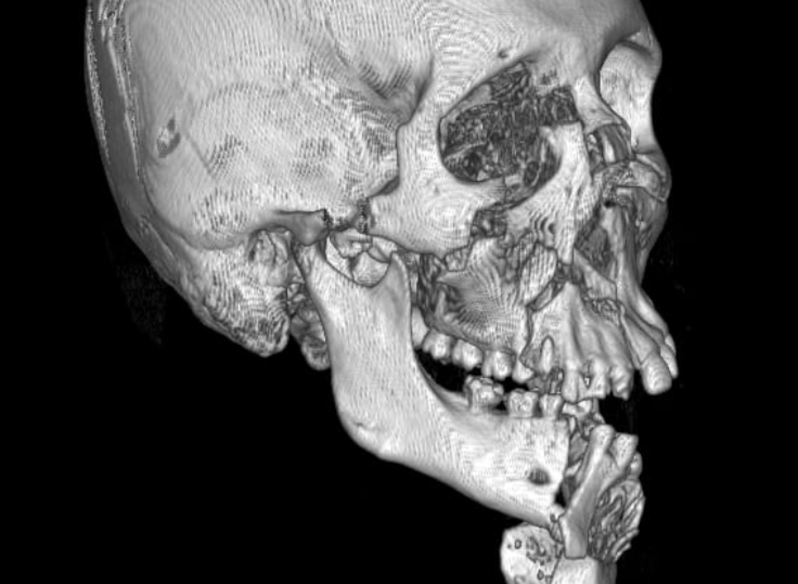 Foto: Divulgação/Hospital da Restauração