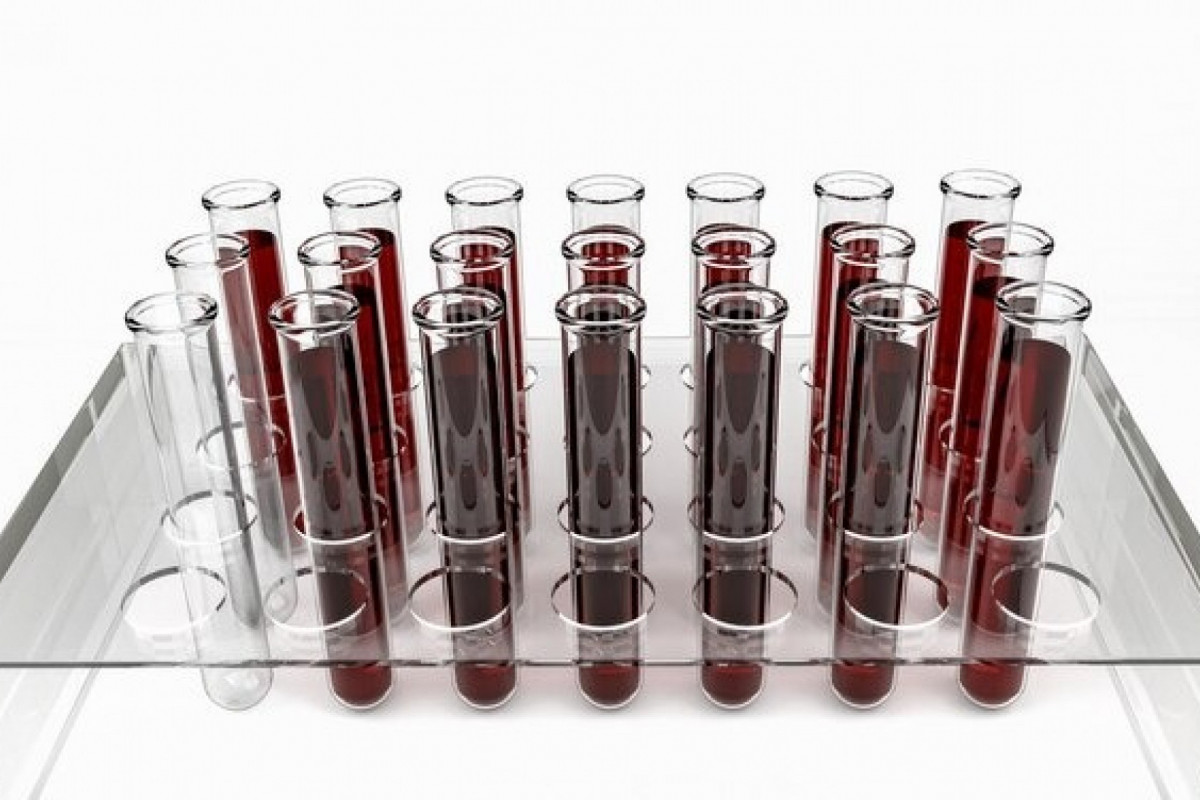Amostras de sangue para confirmar leishmaniose (Foto: Free pik) Amostras de sangue para confirmar leishmaniose/Foto: Free pik