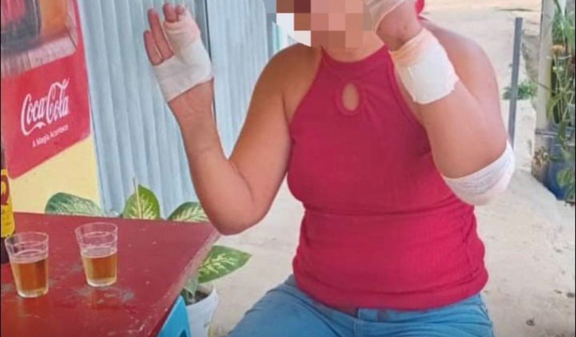 Mulher foi agredida após cobrar pensão em Caruaru/Foto: Reprodução/Instagram