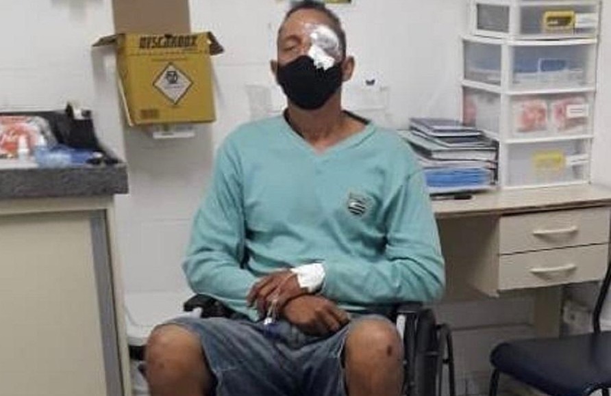 Daniel Campelo da Silva foi atingido durante um ato contra o então presidente Bolsonaro, no Recife, em maio de 2021/Reprodução/Whatsapp