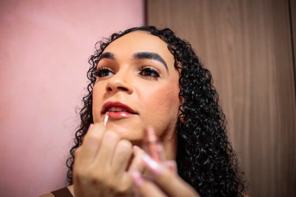 Leona Catalina acionou a Justiça para conseguir colocar próteses (Crysli Viana/DP Foto)