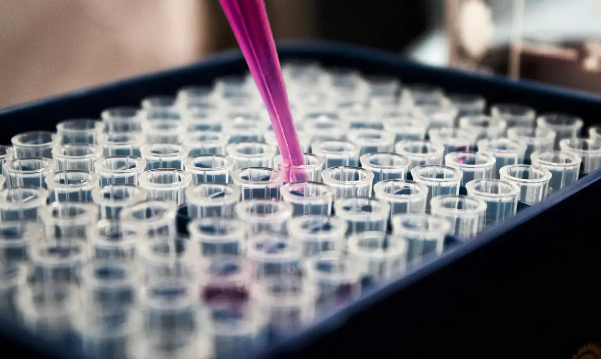 Estudos recentes feito por cientistas brasileiros confirmaram o potencial de um exame de sangue para o diagnóstico do Alzheimer (Foto: Louis Reed/Unsplash) Estudos recentes feito por cientistas brasileiros confirmaram o potencial de um exame de sangue para o diagnóstico do Alzheimer/Foto: Louis Reed/Unsplash