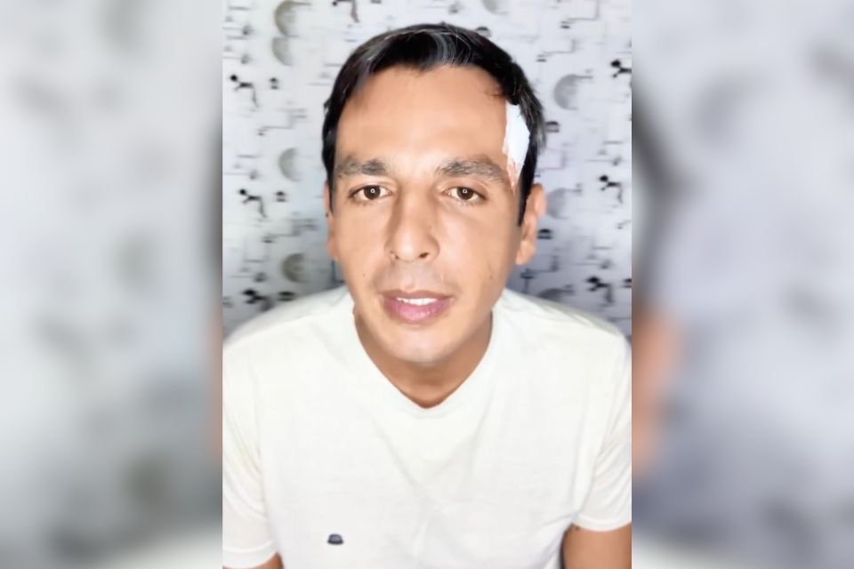 Em vídeo postado nas redes sociais, o jornalista explicou que teve apenas ferimentos leves e que tudo não passou de um "livramento"
 (Foto: Reprodução/Instagram @rafaelcabraltv)