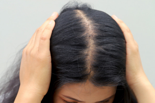 Foto ilustrativa/ Canva