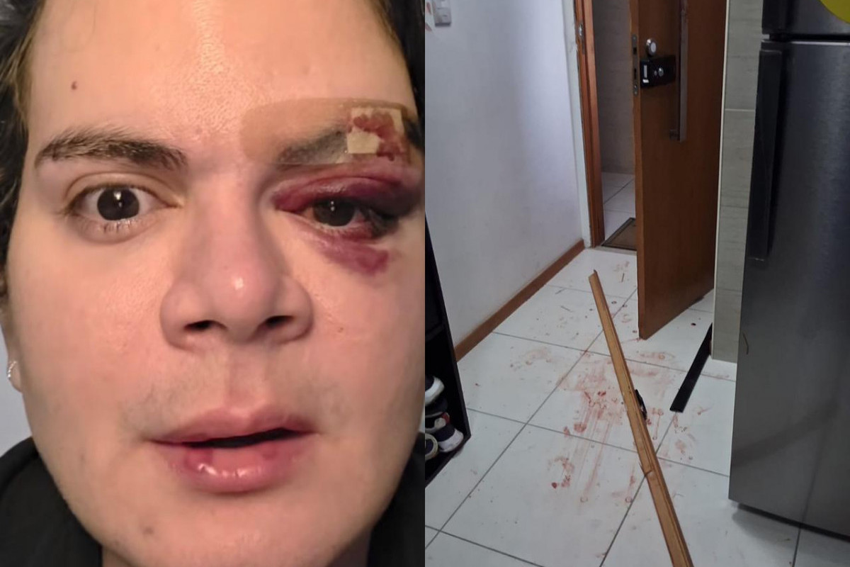 Anderson ficou com ferimentos no rosto após agressões/Foto: Reprodução/Whatsapp