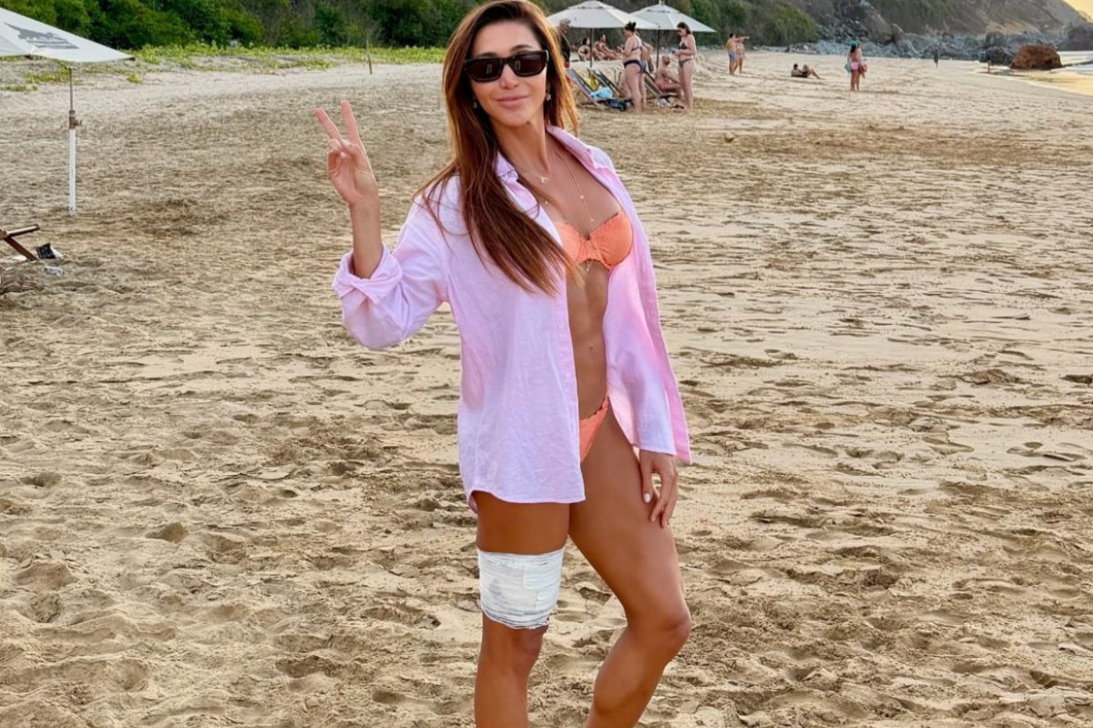 Tayane Cachoeira Dalazen, de 36 anos, agora se recupera de mordida /Foto: Reprodução/Instagram