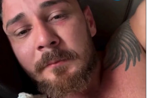 Turista foi diagnosticado com pelo menos quatro fraturas faciais 