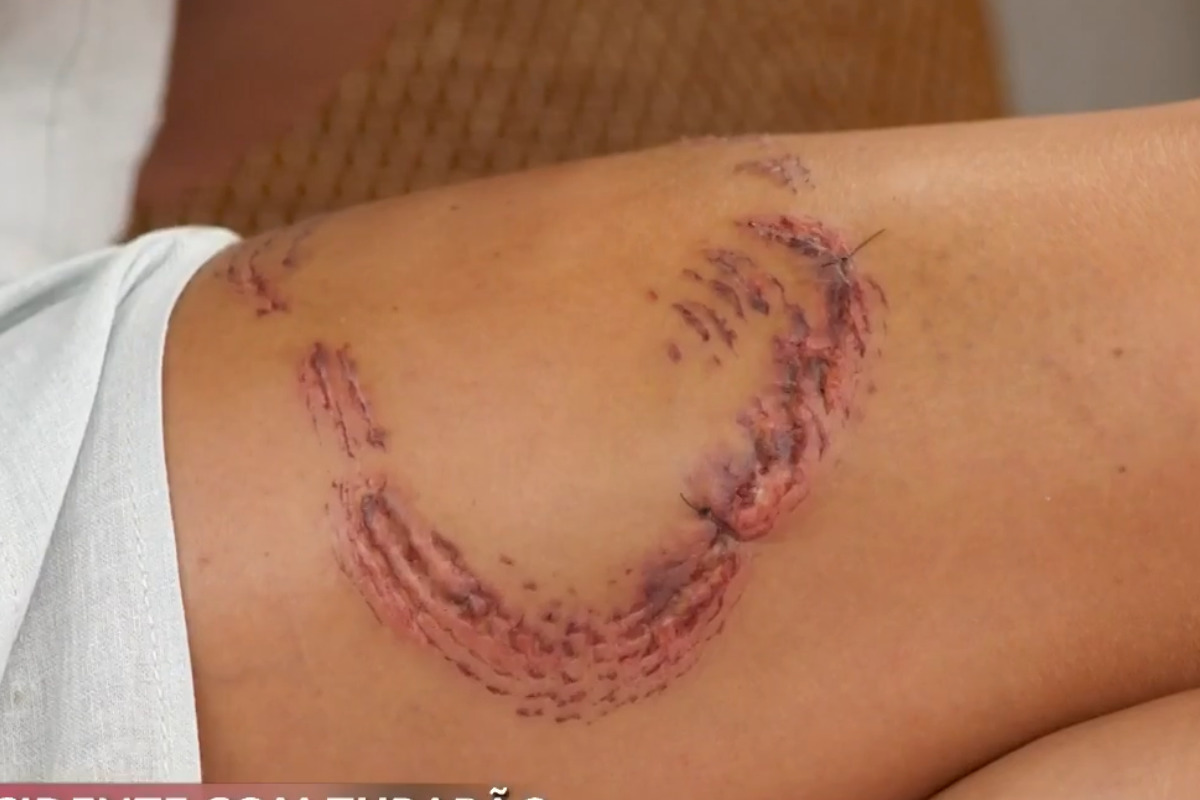 O incidente com tubarão aconteceu na ilha de Fernando de Noronha, na sexta-feira (9)/Foto: Reprodução de vídeo/TV Globo