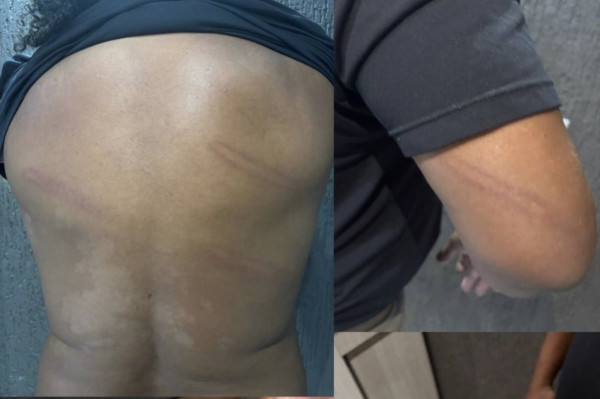 Ex-jogador Perdigão é agredido por policiais/Reprodução