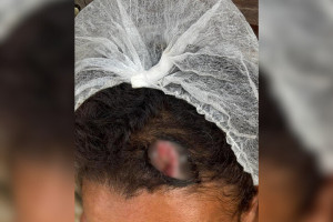 Den&uacute;ncia an&ocirc;nima leva a resgate de mulher v&iacute;tima de viol&ecirc;ncia dom&eacute;stica em Caruaru