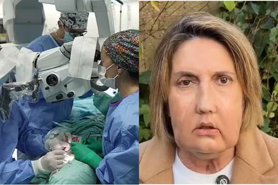Cirurgia de transplante facial durou 24 horas /Reprodução/HOSPITAL VALL D'HEBRON
