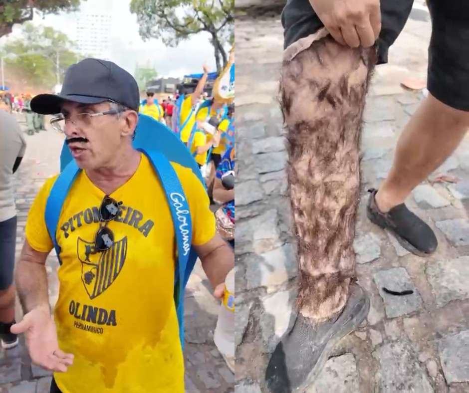  Fantasia de folião faz referência à lenda urbana recifense e ao cinema local, no Galo da Madrugada 2026./DP Foto