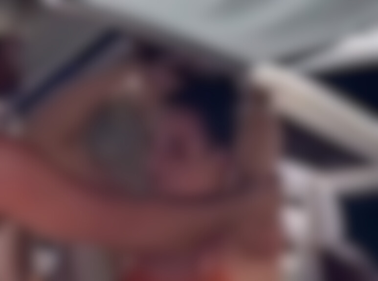 Mulher sofreu um corte acima do olho./Foto: Reprodução/Redes sociais