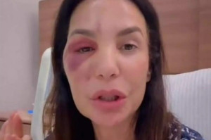 Ivete Sangalo ap&oacute;s cirurgia 