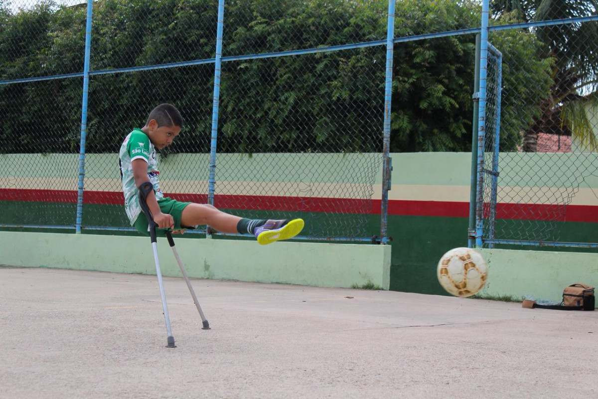 Com menos de dois anos, Jhonantan Gabriel foi diagnosticado com um câncer na perna direita, que fez com que ele tivesse que amputá-la. (Foto: Antônia Di Guimarães / Cortesia)