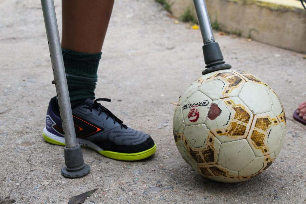 Com menos de dois anos, Jhonantan Gabriel foi diagnosticado com um câncer na perna direita, que fez com que ele tivesse que amputá-la. (Foto: Antônia Di Guimarães / Cortesia)