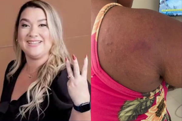 Carolina Sthela Ferreira dos Anjos | Hematoma da vítima /Reprodução/Redes sociais | Divulgação/PCMA