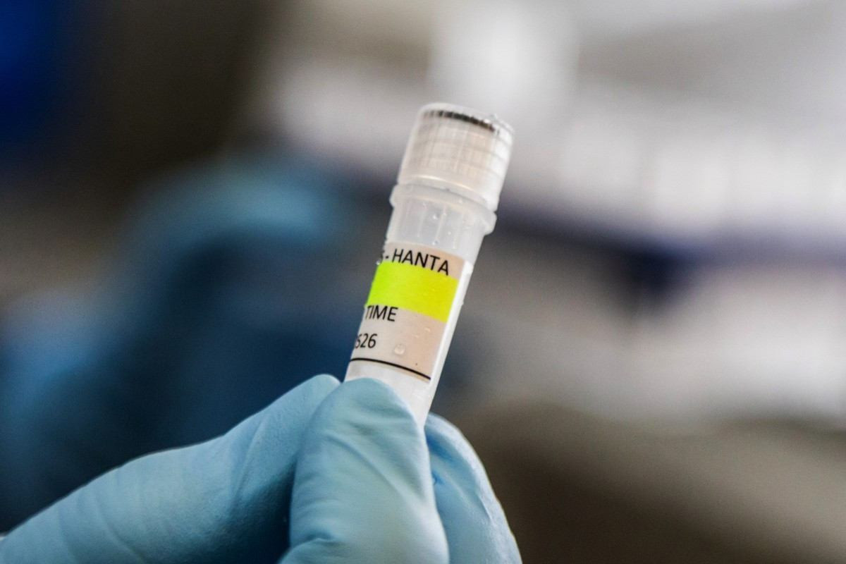 Recipiente usado para diagnosticar o hantavírus andino /AFP