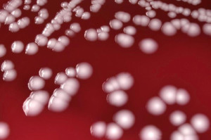 Superbact&eacute;ria Acinetobacter Baumannii 