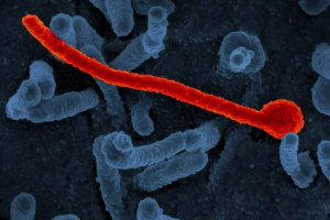 S&atilde;o Paulo investiga caso suspeito do v&iacute;rus Ebola em paciente de 37 anos