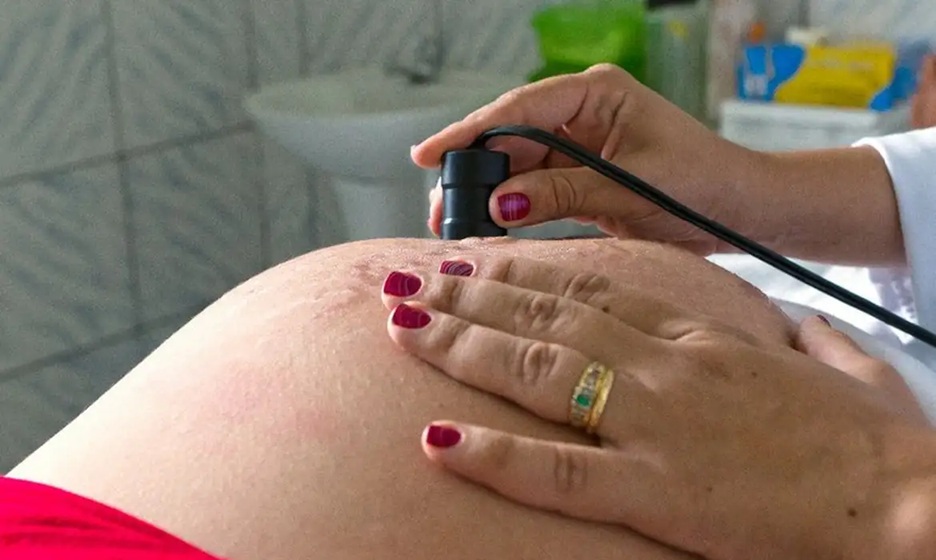 Resultado está associado, entre outros fatores, ao maior acesso ao pré-natal estimulado pelas condicionalidades do Bolsa Família/Arquivo/MDS