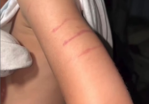 Menino de 5 anos é encontrado com hematomas após sair de escola em Caruaru
/Foto: Reprodução/Redes