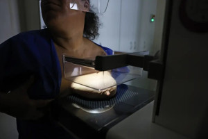 A ANS defende a obrigatoriedade de cobertura de exame de mamografia digital para todas as pessoas, sempre que houver indica&ccedil;&atilde;o m&eacute;dica

