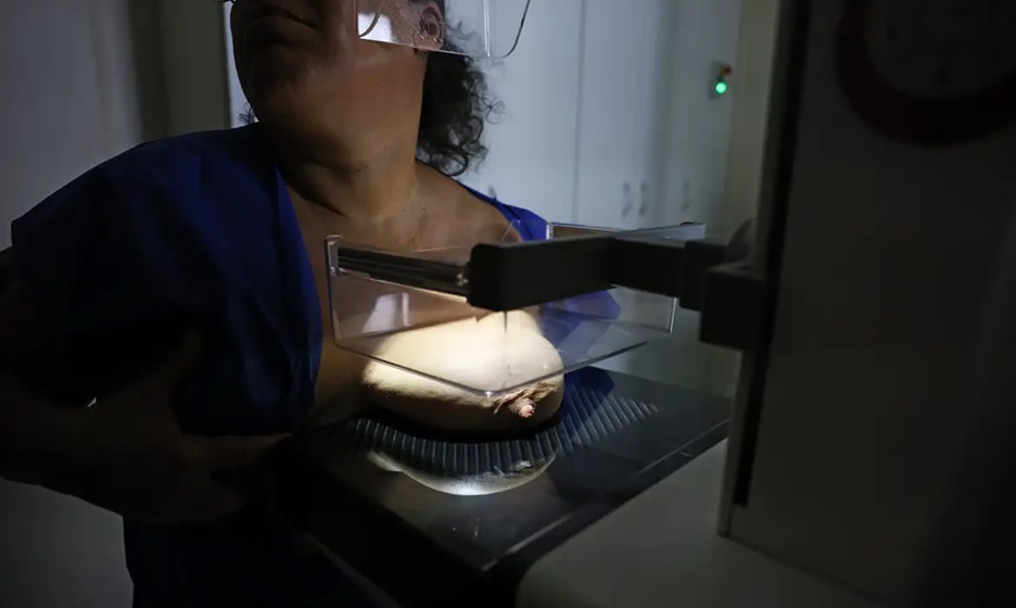 A ANS defende a obrigatoriedade de cobertura de exame de mamografia digital para todas as pessoas, sempre que houver indicação médica

/José Cruz/Agência Brasil