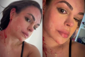 Ex-primeira-dama de Granito, no Sert&atilde;o de Pernambuco, denuncia ter sofrido viol&ecirc;ncia dom&eacute;stica