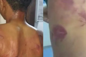 Agress&otilde;es ocorreram na &uacute;ltima quinta-feira (27)
