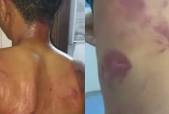 Agressões ocorreram na última quinta-feira (27)/Reprodução/Redes sociais