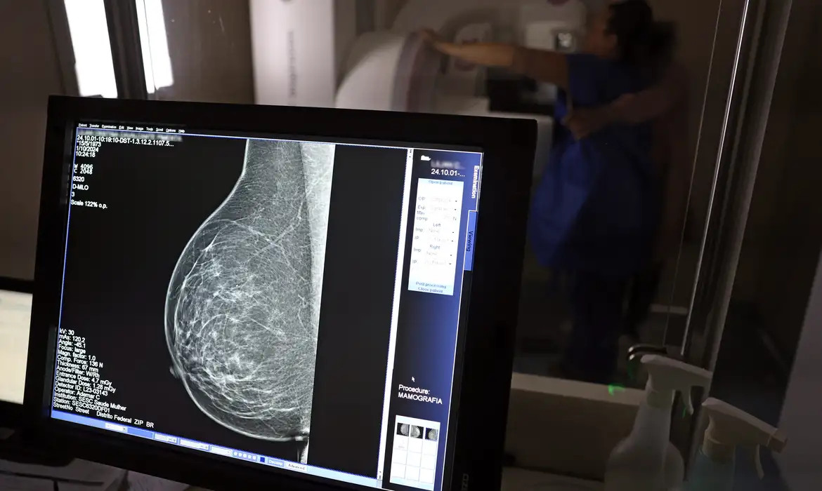 A mamografia digital é considerada um dos principais exames para a detecção precoce do câncer de mama/JOSÉ CRUZ/AGÊNCIA BRASIL