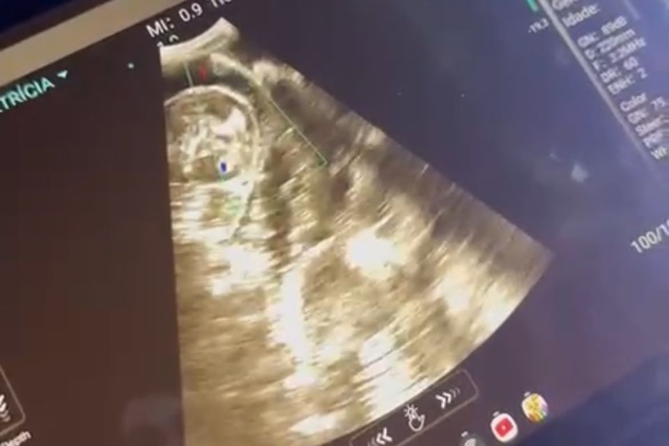 Filhote de tubarão-tigre é flagrado abrindo a boca dentro do ventre da mãe em Fernando de Noronha/Foto: Reprodução/Whatsapp