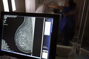 Exames e orienta&ccedil;&otilde;es de sa&uacute;de integram a programa&ccedil;&atilde;o do Outubro Rosa, m&ecirc;s dedicado &agrave; conscientiza&ccedil;&atilde;o sobre o c&acirc;ncer de mama