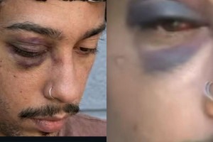 Rapper levou chutes na regi&atilde;o do rosto