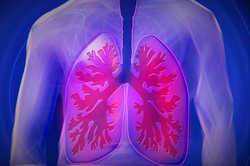 Agosto Branco aborda sobre a conscientização do câncer de pulmão (Foto: Reprodução/Pixabay)