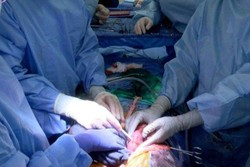 Rins de porco são transplantados em paciente com morte cerebral (Foto: AFP)