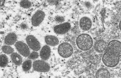 Três novos caso de varíola dos macacos são confirmados, em Pernambuco (Foto: AFP.)