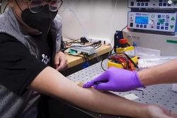 Adesivo de ultrassom registra órgãos internos enquanto usuário se movimenta (Foto: Divulgação/MIT)