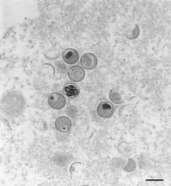 Mais de 5 mil casos de varíola dos macacos são confirmados no mundo, anuncia OMS (Foto: FREYA KAULBARS / RKI ROBERT KOCH INSTITUTE / AFP)