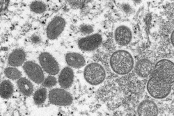 Pesquisa indica que 'não é raro' achar o vírus da varíola do macaco no sêmem (crédito: CYNTHIA S. GOLDSMITH)