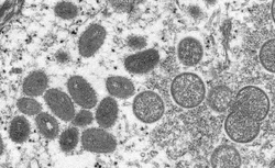 Ceará confirma primeiro caso de varíola dos macacos no estado (Foto: Centro de Controle de Doenças/Divulgação
)