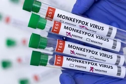 Casos de varíola dos macacos chegam a 76 em todo o país  (Foto:Divulgação. )