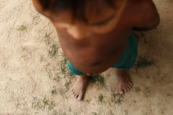 Criança ianomâmi de 1 ano morre vítima de desnutrição grave  (Foto: Fernando Frazão/Agência Brasil
)