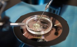 Após divórcio, embriões de fertilização in vitro podem ser descartados no DF (Foto: Reprodução/Shutterstock)